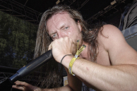 Stillbirth